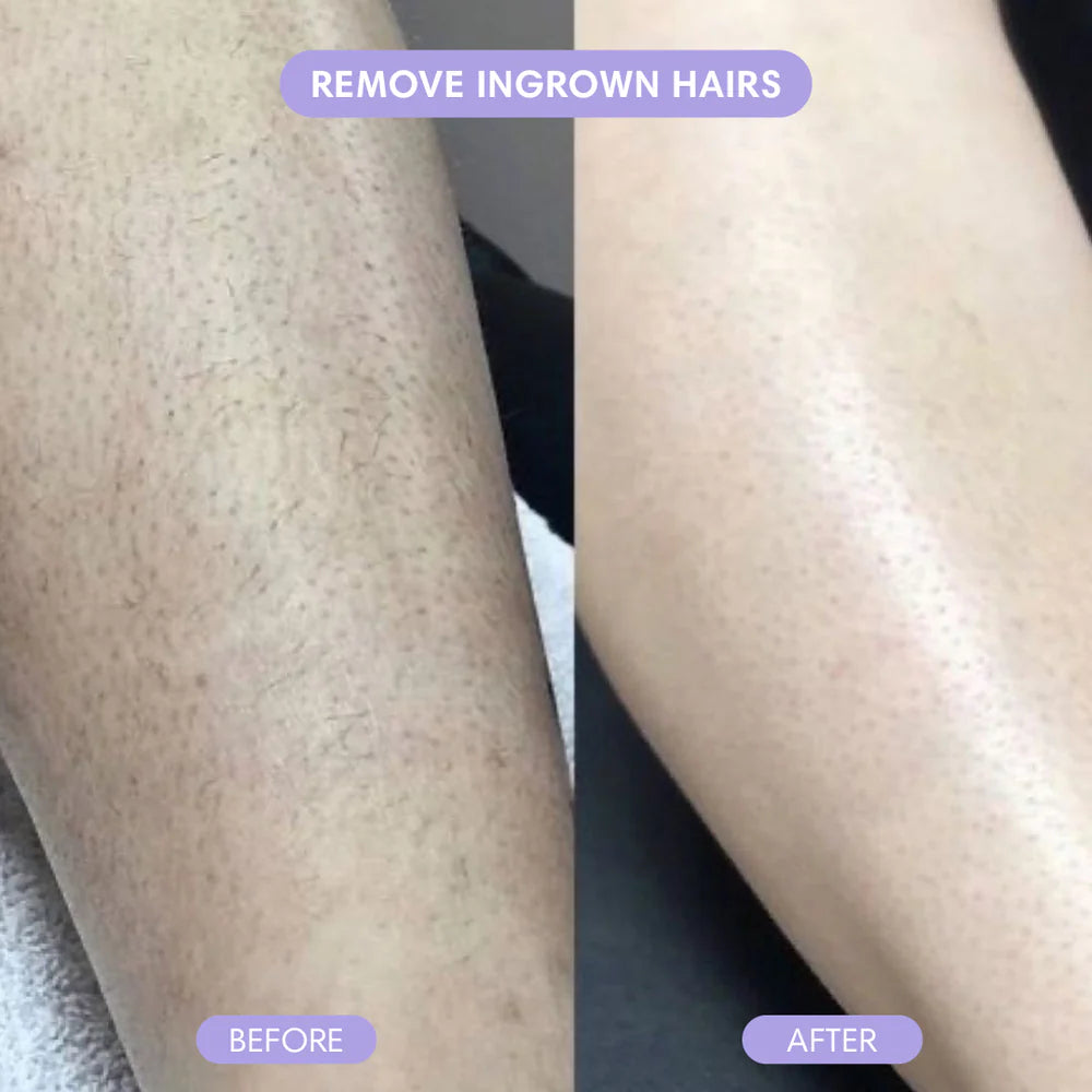 BareGlow Crystal Hair Remover